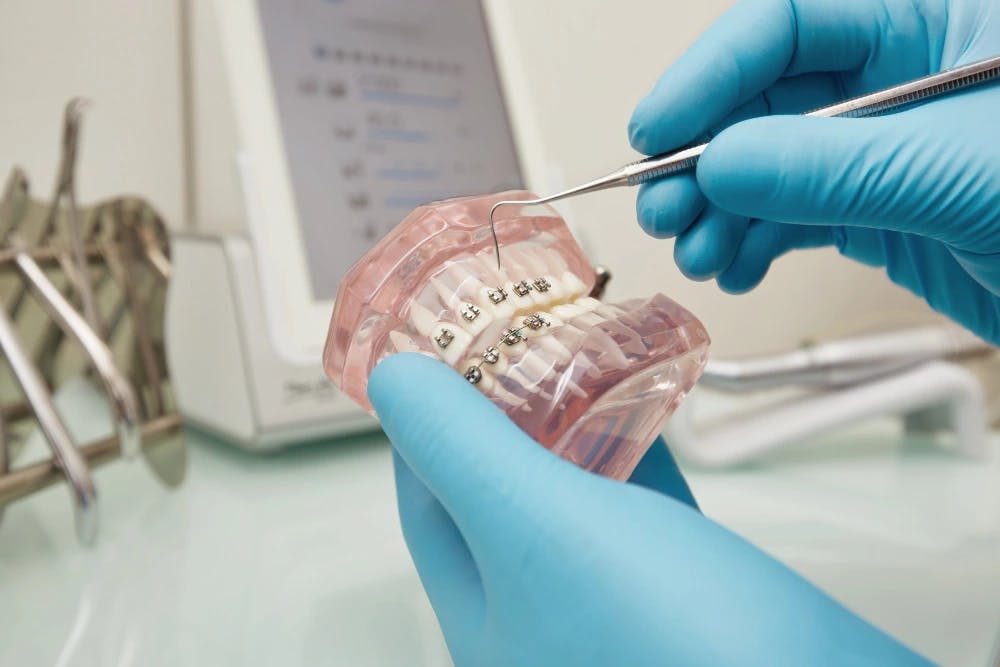 Dentista Topdentist manipulando ortodoncia
