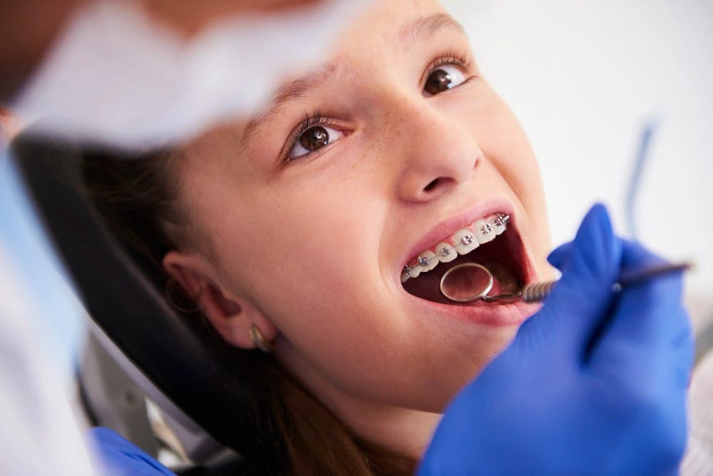 Topdentist revisión de la ortodoncía